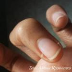 Şeytan tırnakları neden sıklıkla parmaklarda görülür, nasıl tedavi edilir, nasıl çıkarılır?