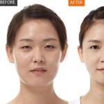 Ameliyatsız yüz gençleştirme için Zogan (Asahi) masajı