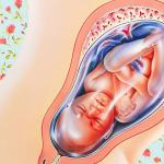 Hamilelik sırasında oligohidramnios: nedenleri ve sonuçları