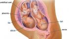 Hamilelik sırasında oligohidramnios - nedenleri, tanı, dereceler, tedavi ve doğum Oligohidramnios 6 7